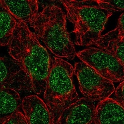 ZNF383 Antibody, Novus Biologicals:Antibodies:Primary Antibodies